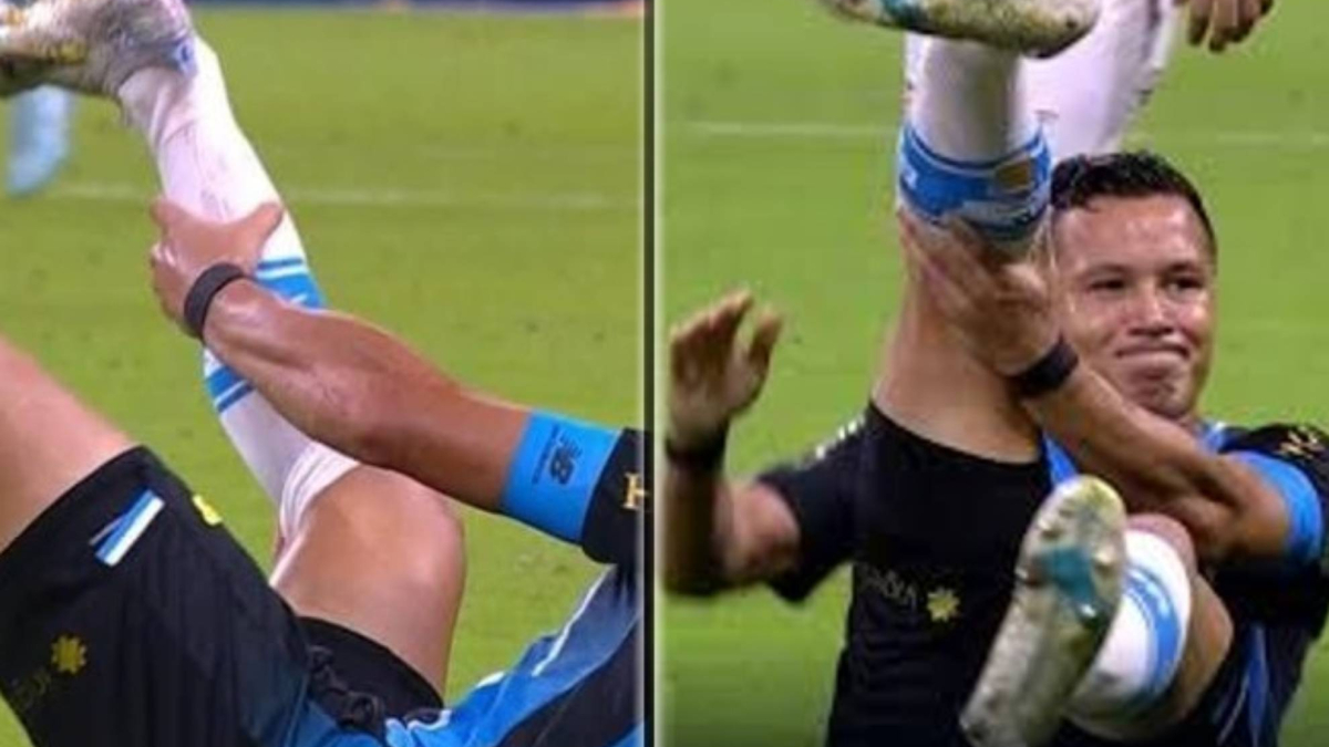 Brutal lesión en Brasil: Marlon se queda con el tobillo colgando tras sufrir una grave fractura