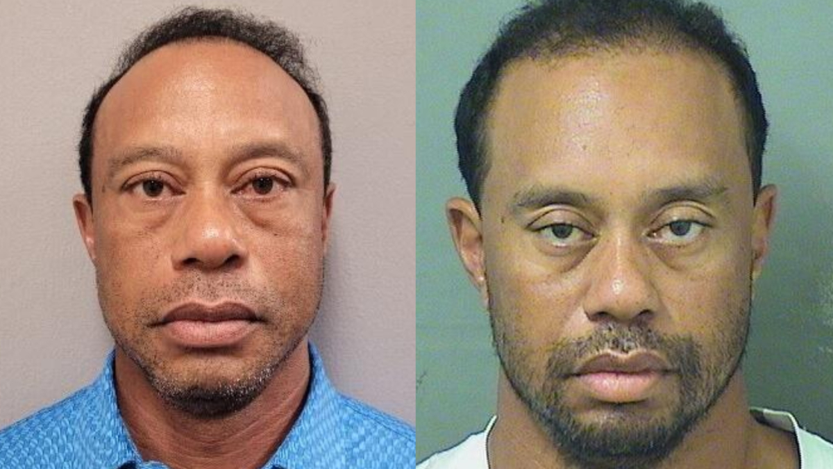 Tiger Woods cần sự giúp đỡ