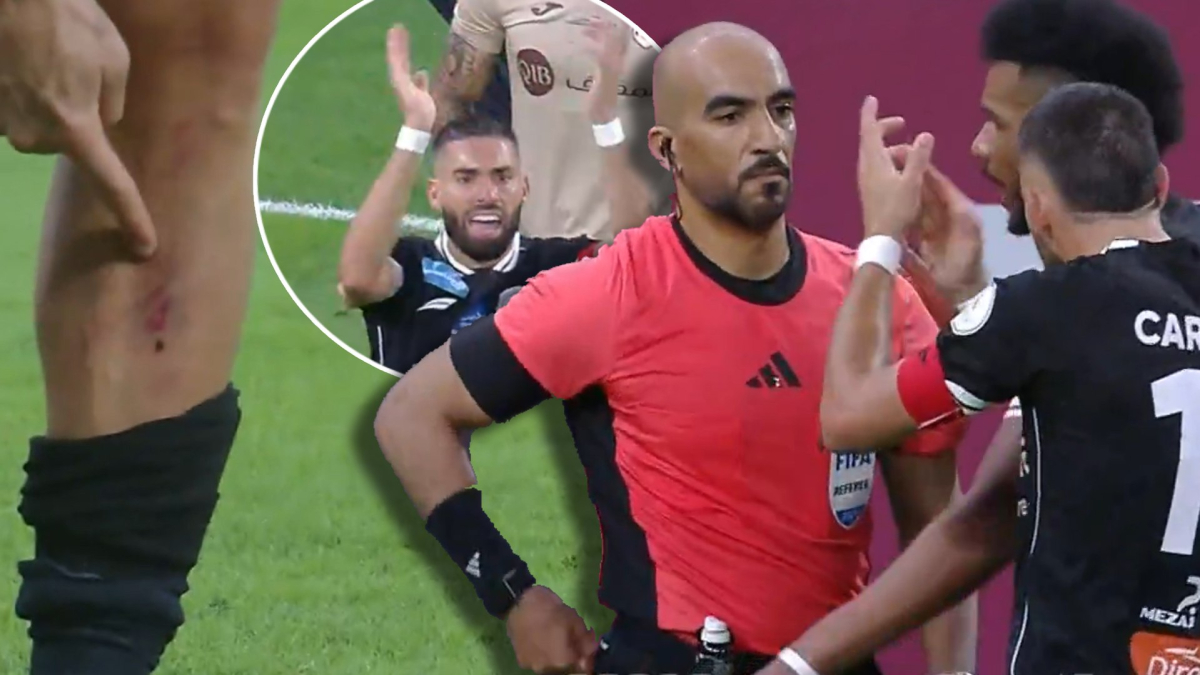 Casi rompen la pierna a Yannick Carrasco... ¡y le sacan la roja a él!