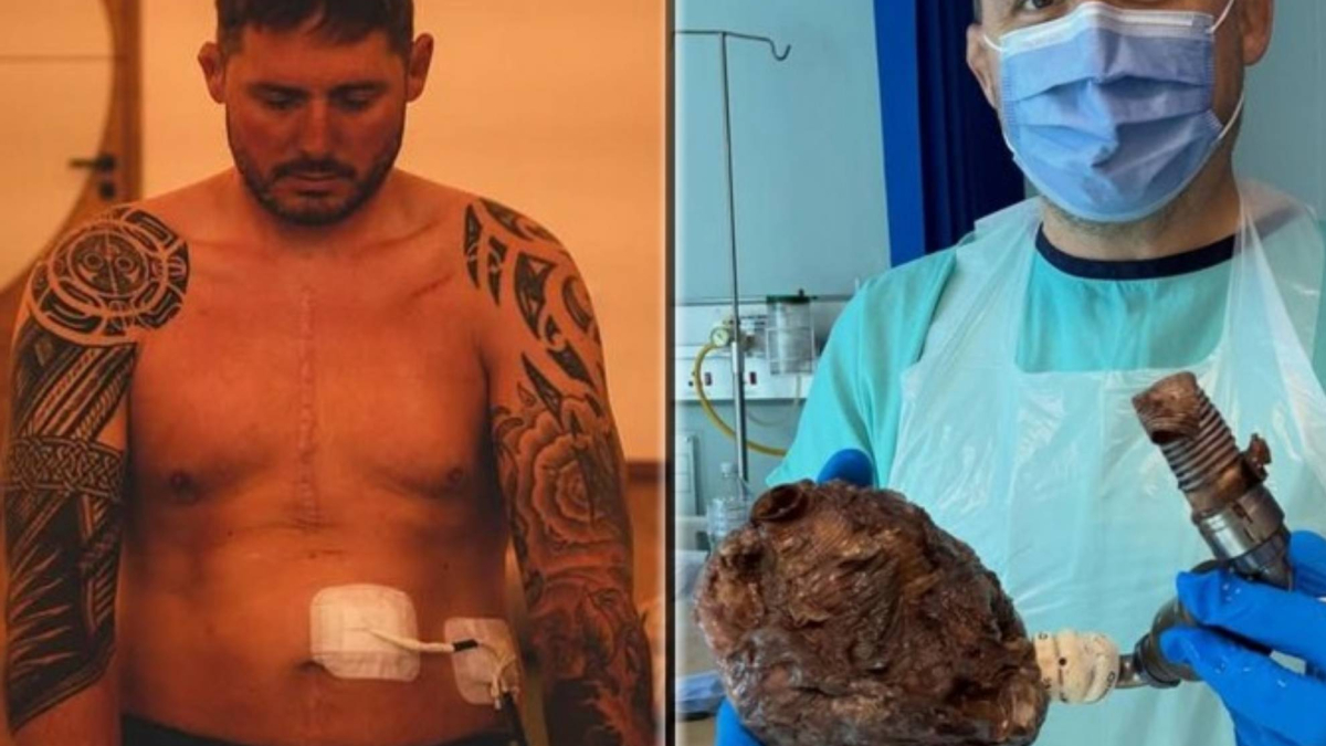 Un jugador de rugby sostiene su corazón entre sus manos: "Mi experiencia más surrealista"