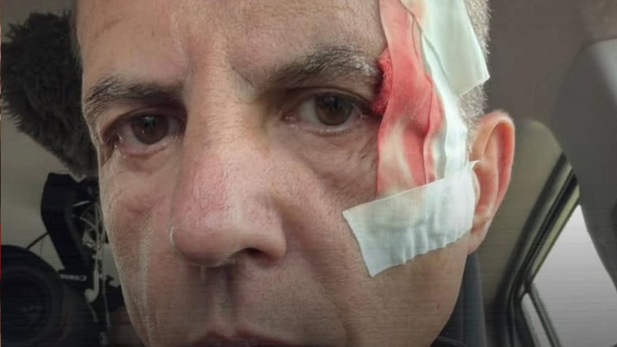 Jesús Calleja mostra un momento di rafting in Costa Rica con Cristóbal Soria, che ha subito un piccolo trauma