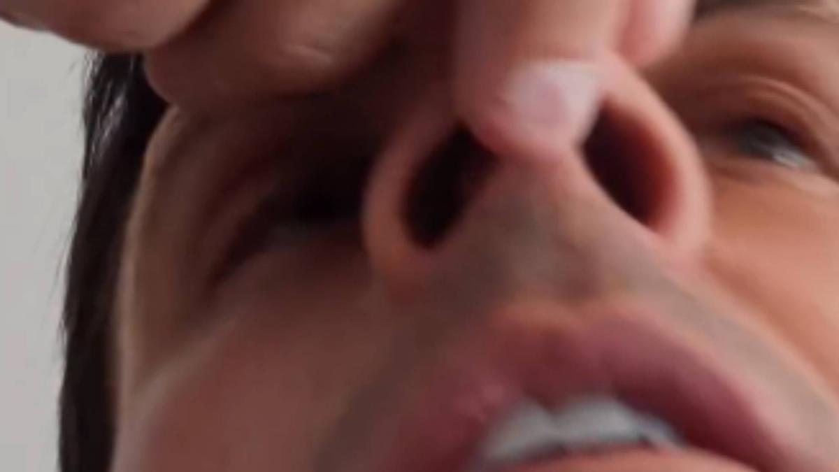 Así se le ha quedado la nariz a Edu Aguirre tras ser noqueado por Omar Montes