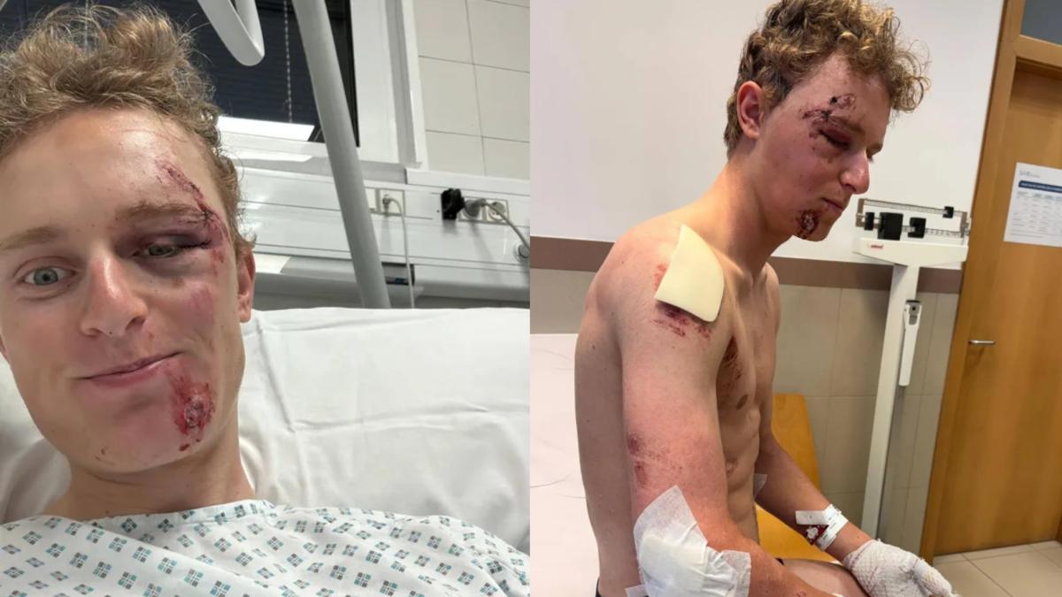 Noticia Ciclismo: Albert Philipsen, tras su grave caída: "Lo siguiente que recuerdo es estar tirado en el suelo" - joseluispolo.es