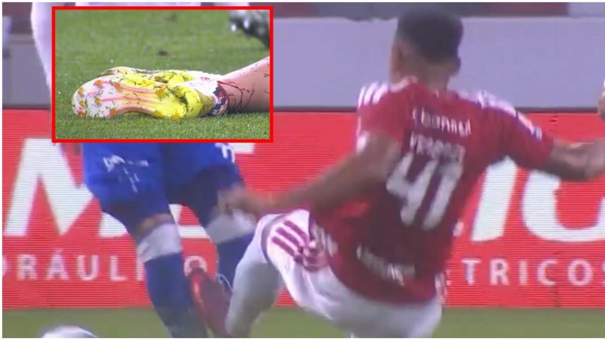 Sanción histórica en Brasil: jugador inhabilitado hasta que su víctima se recupere de la fractura