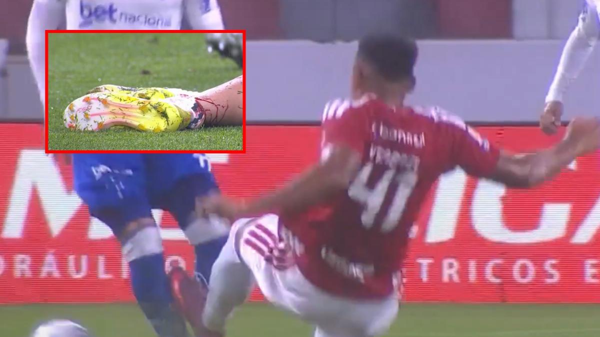The sanction that can change football: he will not play again until the victim recovers