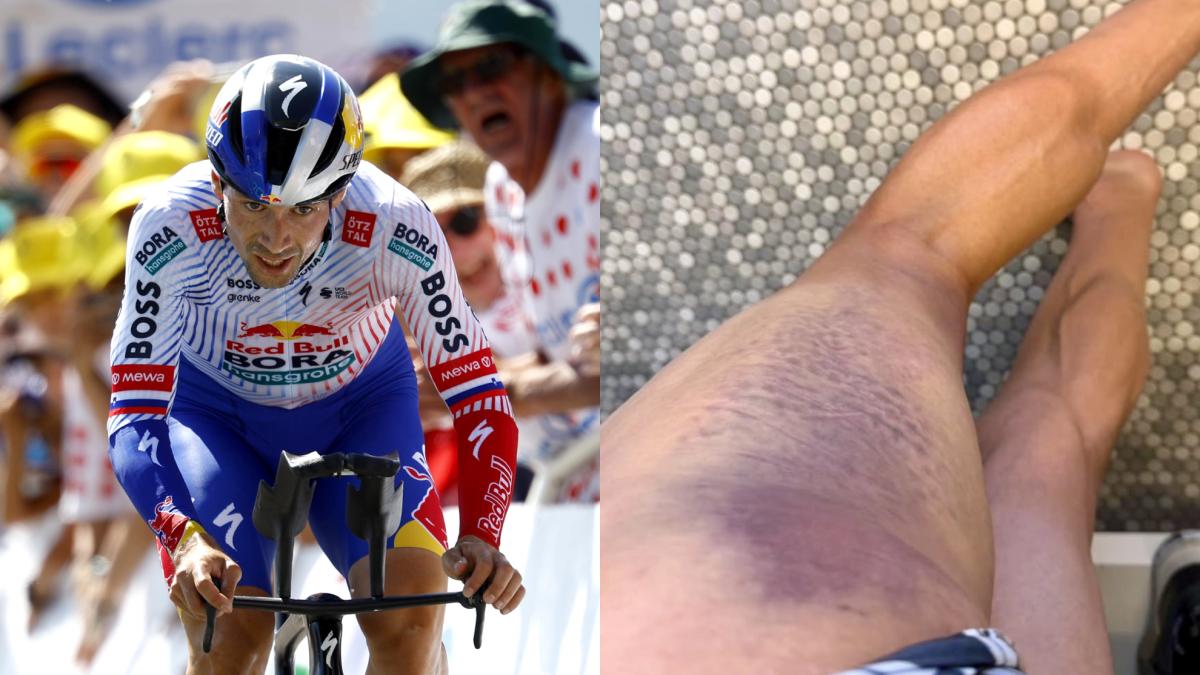 Roglic, heurté par une voiture : adieu à Saint-Sébastien et à la Vuelta à Burgos
