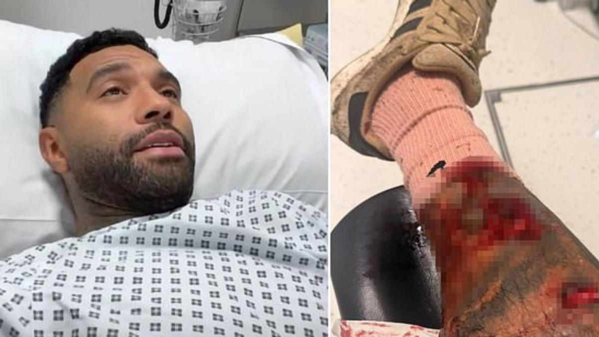 Jermaine Pennant sufre el ataque de un perro: "El mío me salvó la vida"