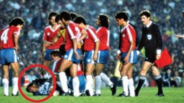 El corte más famoso del fútbol. El portero chileno Roberto Rojas aprovechó el lanzamiento de una bengala para sacar una cuchilla, rajarse la ceja y obligar a suspender el partido.