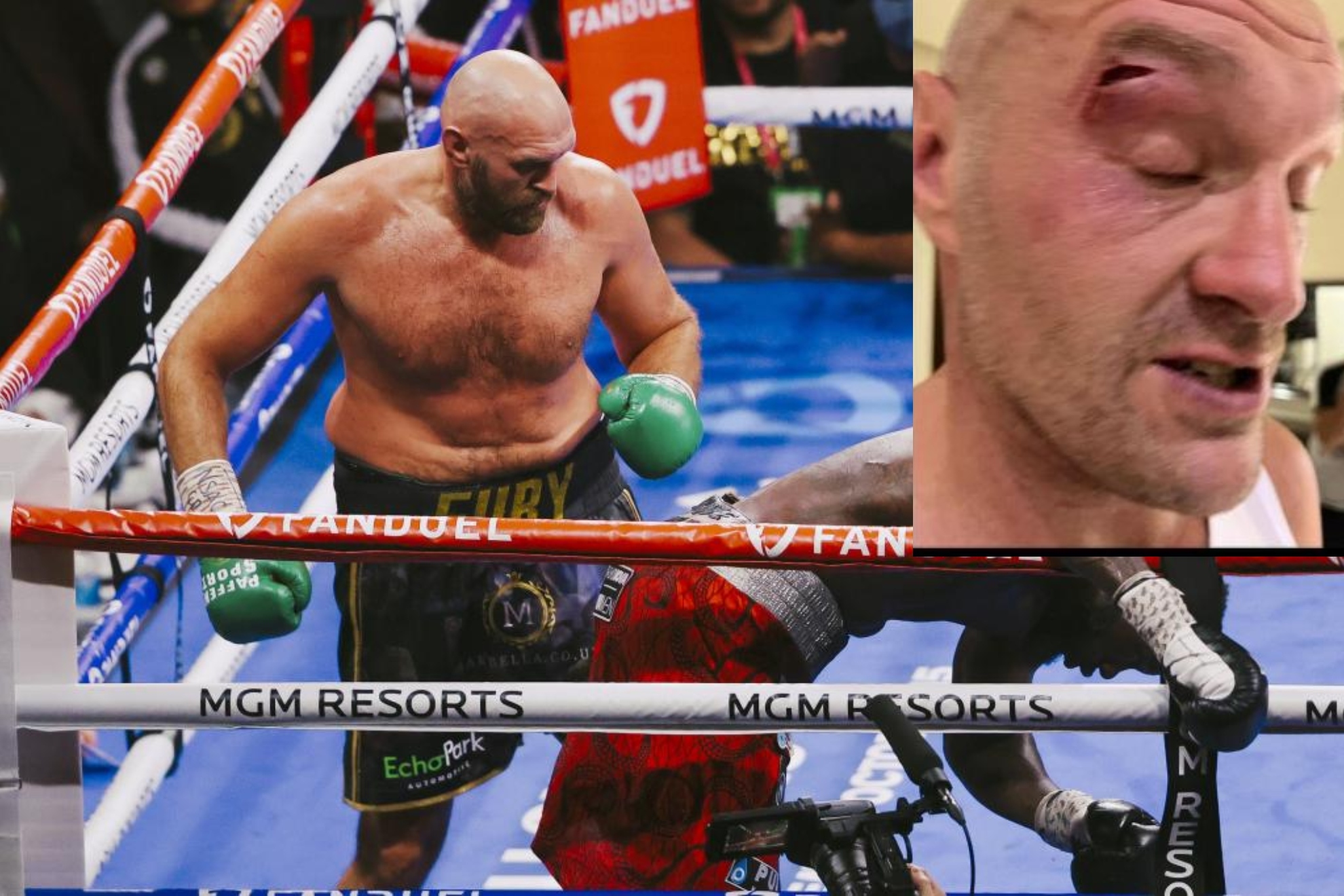 Tyson Fury, en un combate y cómo tiene la ceja tras el corte sufrido.