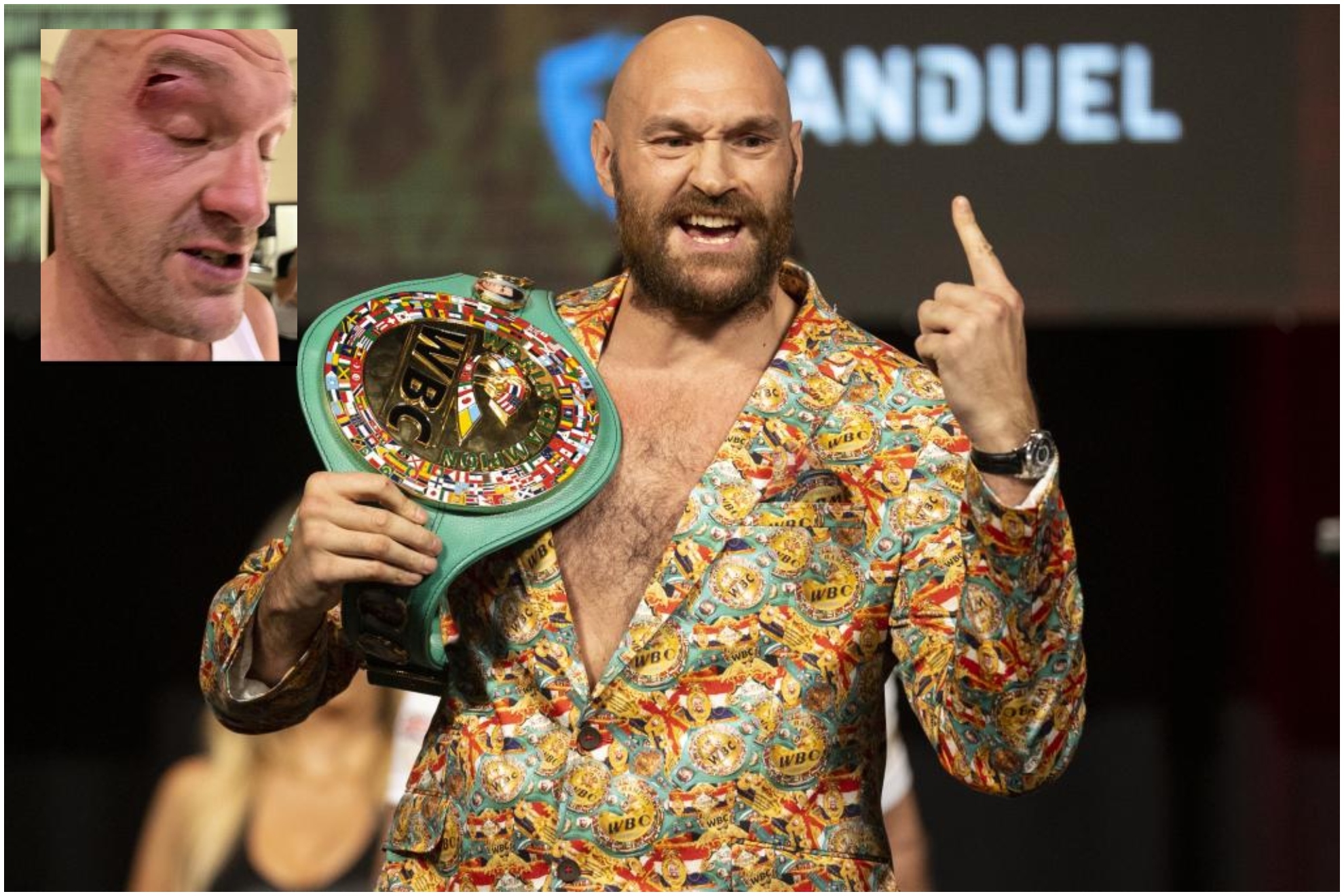 Tyson Fury, con su cinturón de campeón, y la imagen de su ceja tras el golpe recibido.
