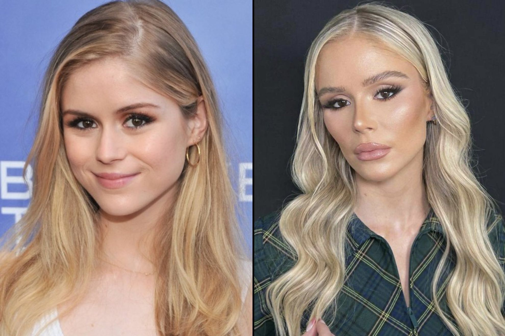 “First To Criticize”: The Boys Fans Regret Cruel Erin Moriarty Backlash After Heartbreaking Health Reveal