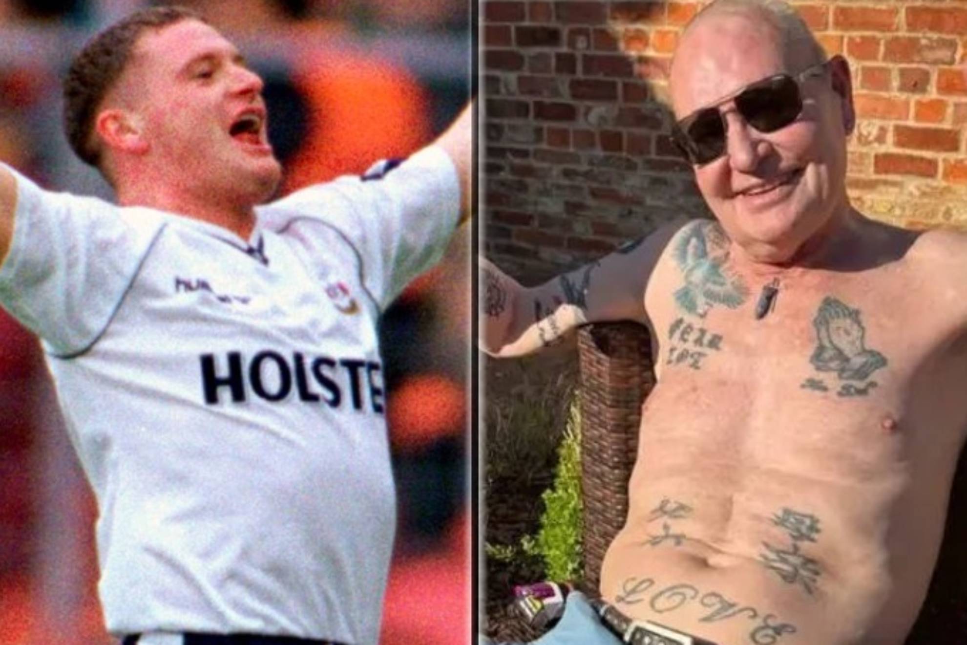 paul gascoigne plastic surgery Image 7
