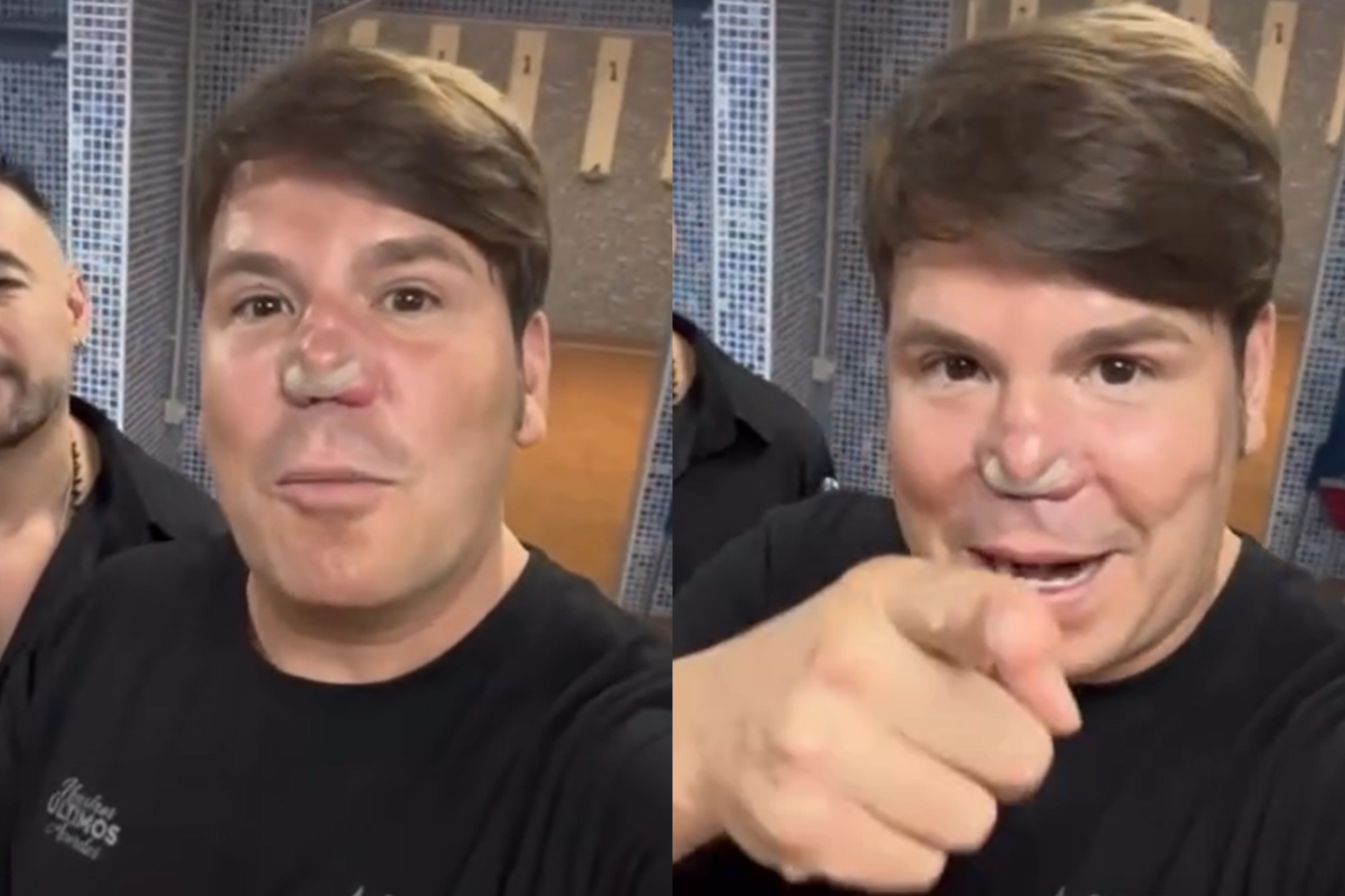 Lucas, de Andy y Lucas, reaparece y la nueva imagen de su nariz desata otra polémica: “Está mutando”