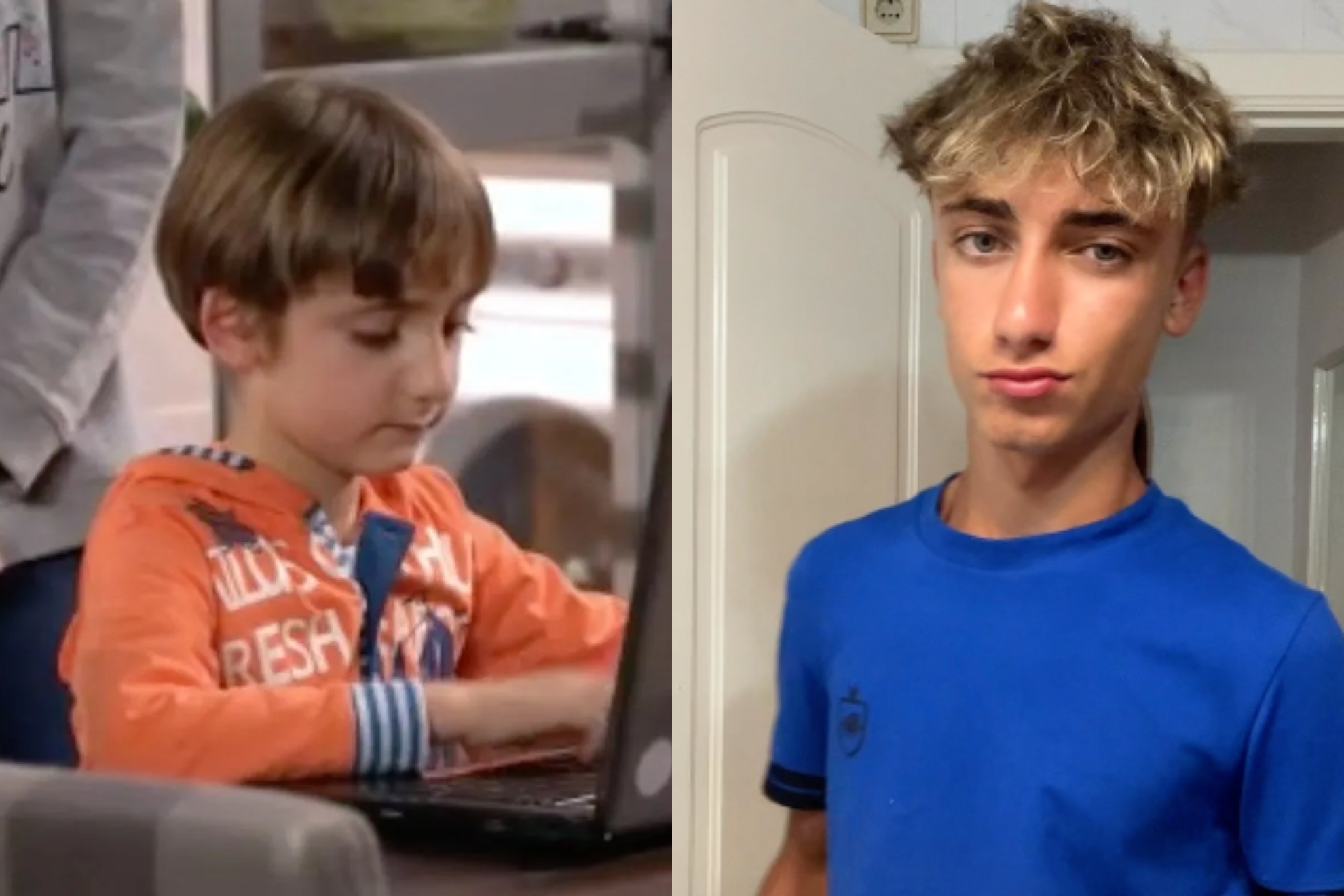 El antes y después de Álvaro Giraldo.