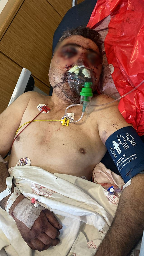 Un boxeador intenta morderle la nariz a un taxista en "un ataque monstruoso": se juega 33 años de cárcel