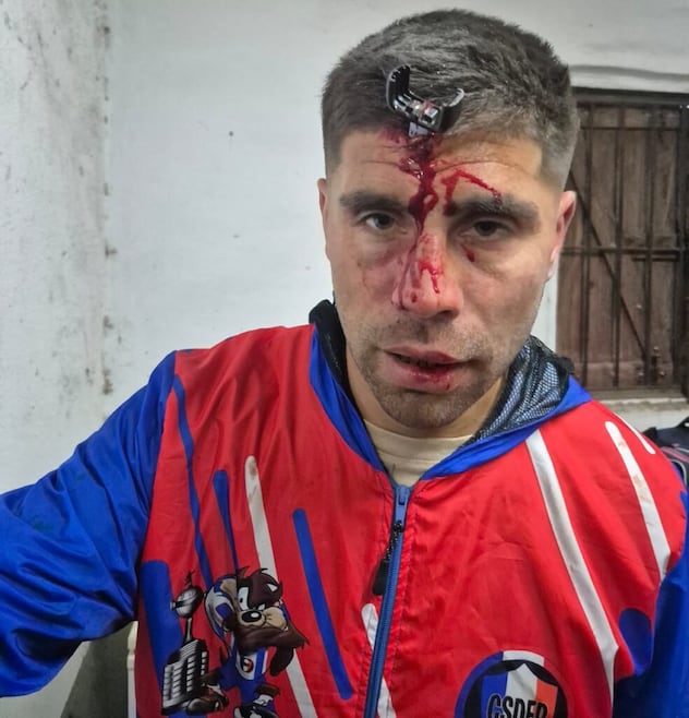 Al futbolista Jonathan Smith le clavan una llave en la cabeza en una pelea durante un partido de fútbol femenino