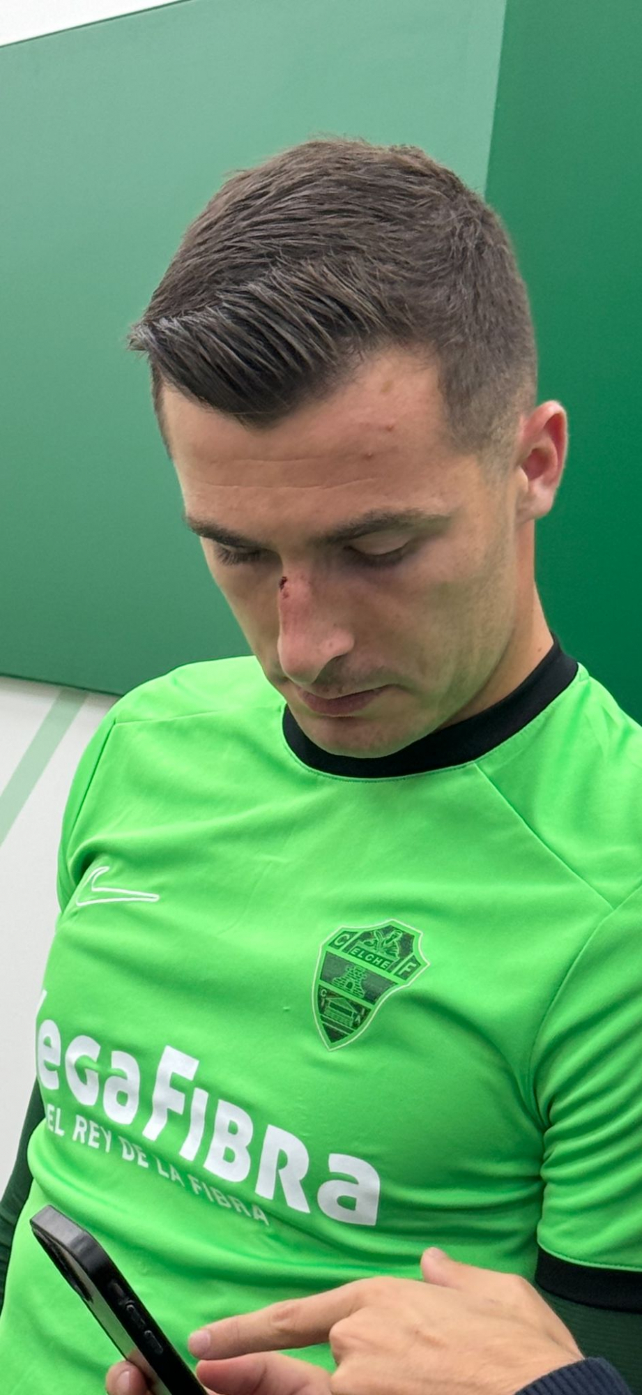 Así quedó la nariz de Iñaki Peña tras su golpe con Vini.