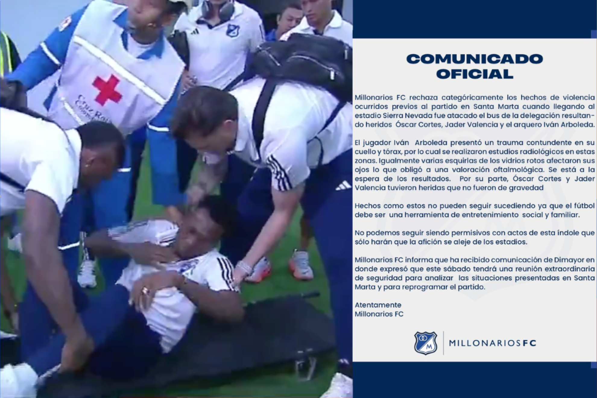 Comunicado de Millonarios por agresión al bus antes del partido contra Unión Magdalena