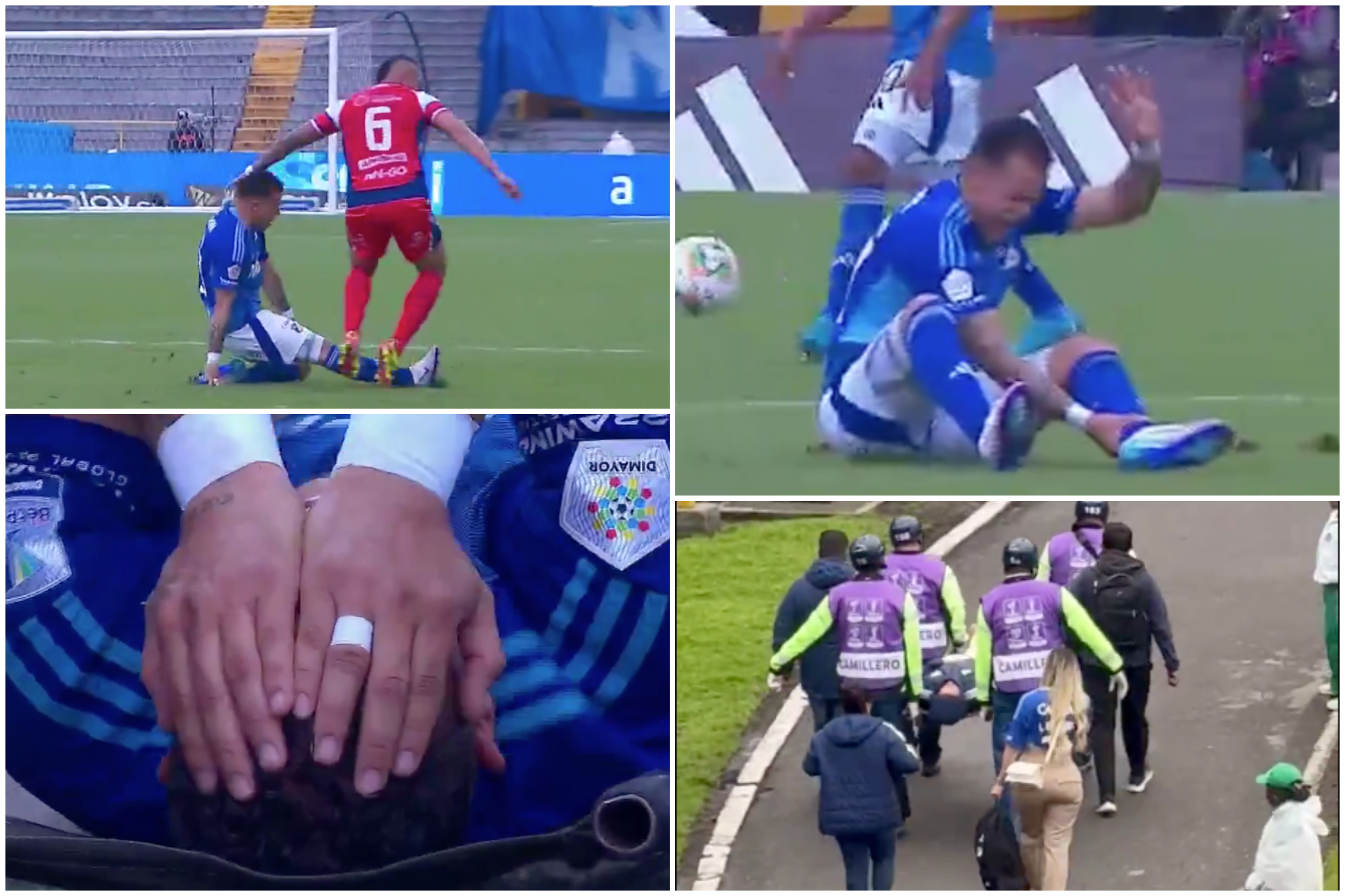 Reacciones por lesión de pantorrilla de Leonardo Castro con Millonarios vs. Alianza FC