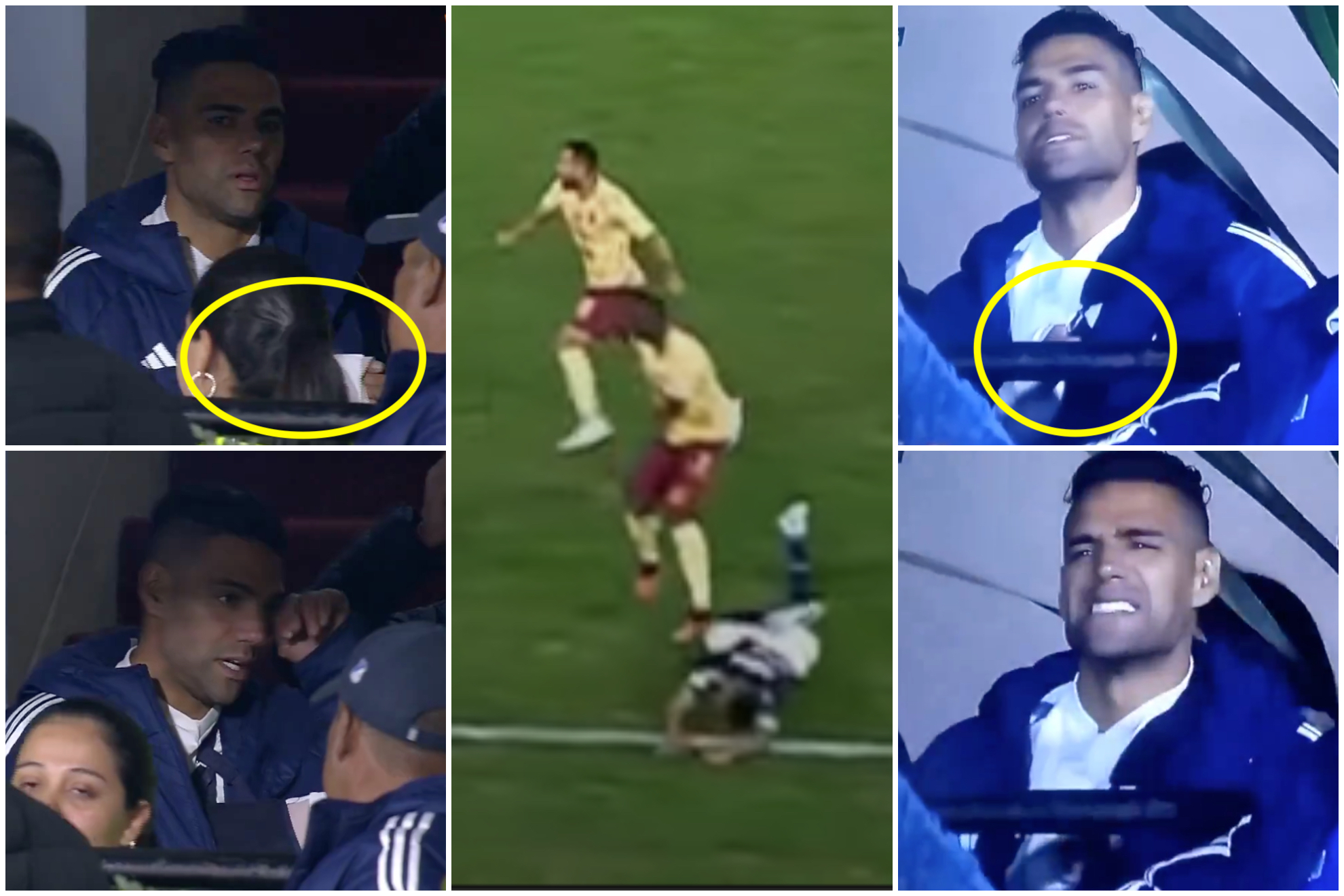 Así fue la fractura de Falcao García en el partido Millonarios vs. Tolima (Win Sports)