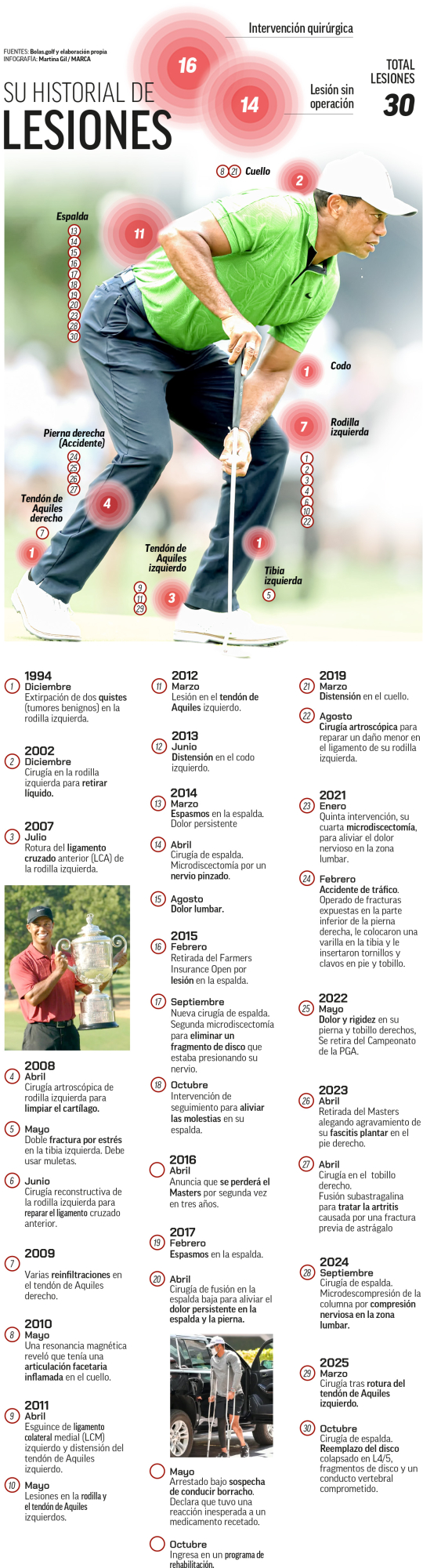 Las lesiones de Tiger Woods.