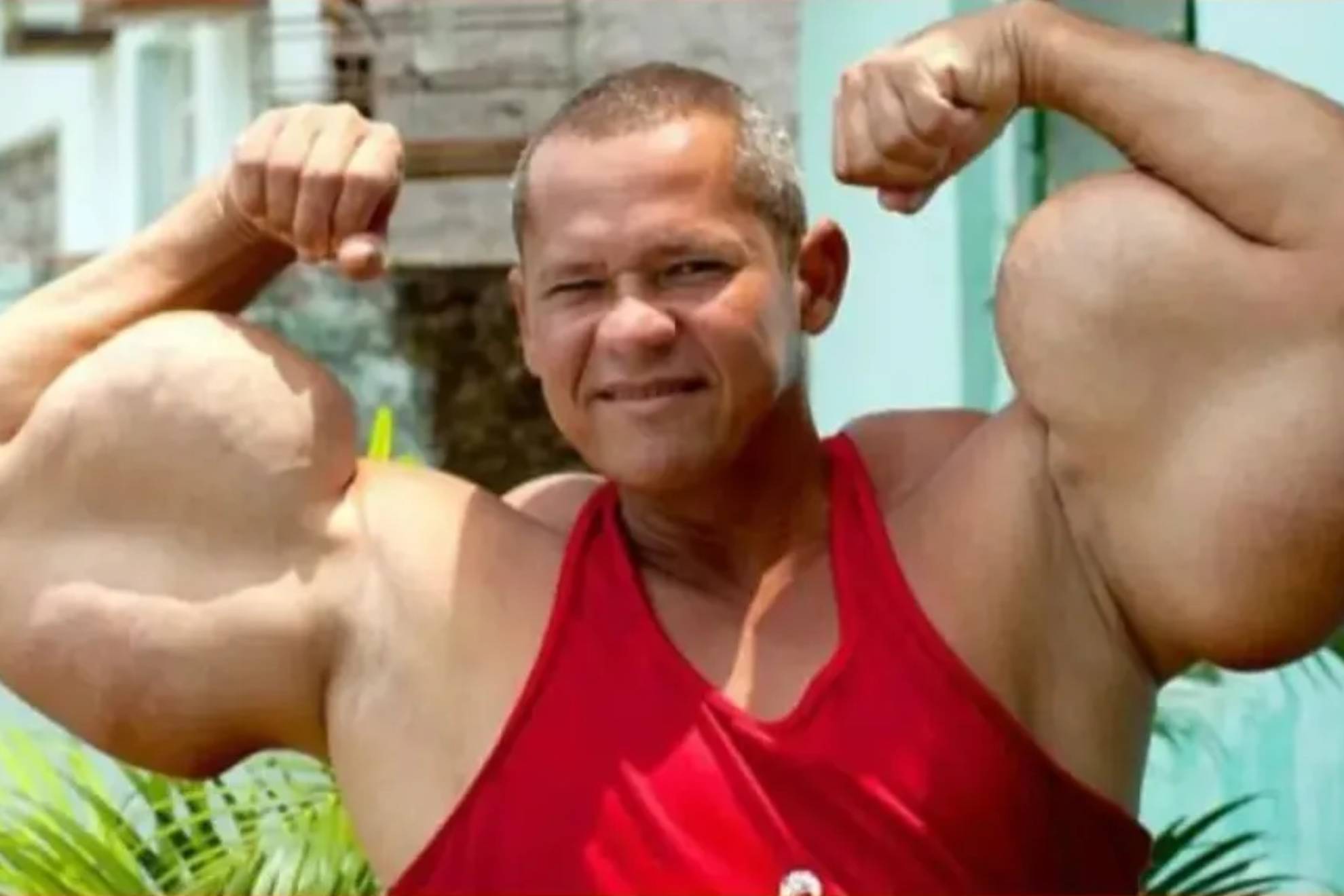 Muere Arlindo de Souza, el Popeye brasileño que se inyectaba aceite para tener los bíceps gigantes
