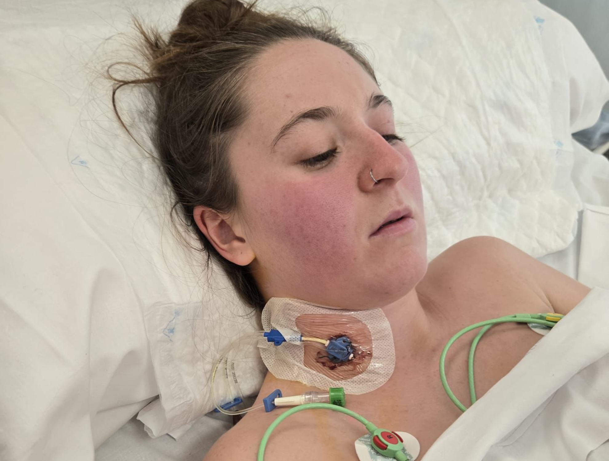 Andrea Miguélez, tras la última operación.