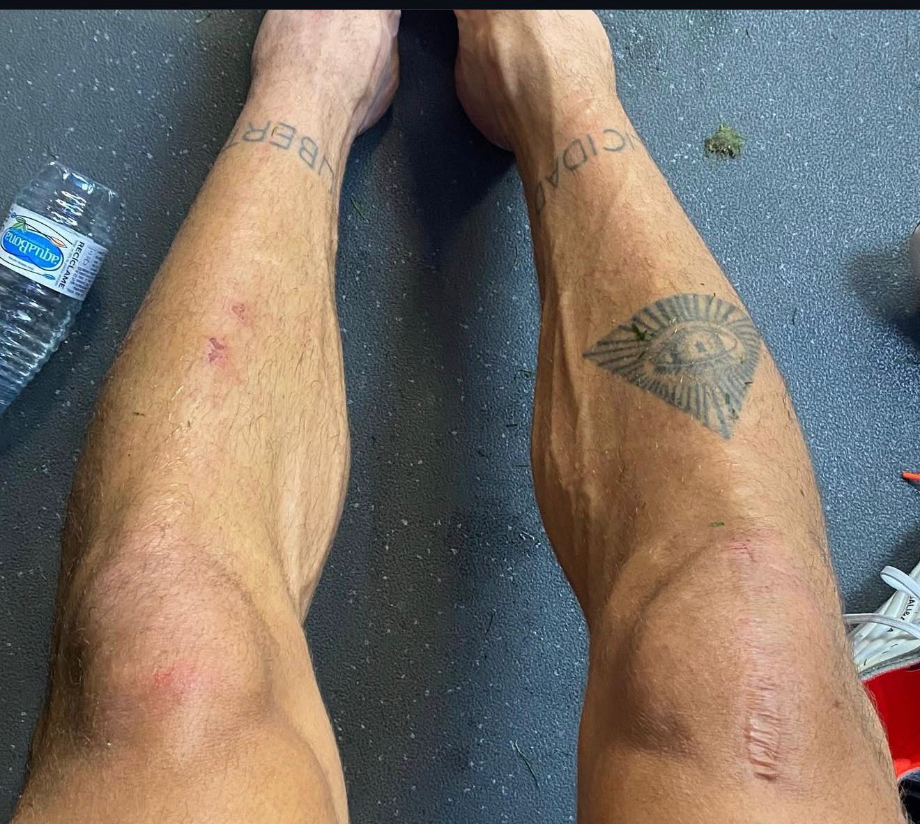 La rodilla de Piccini está dañada.