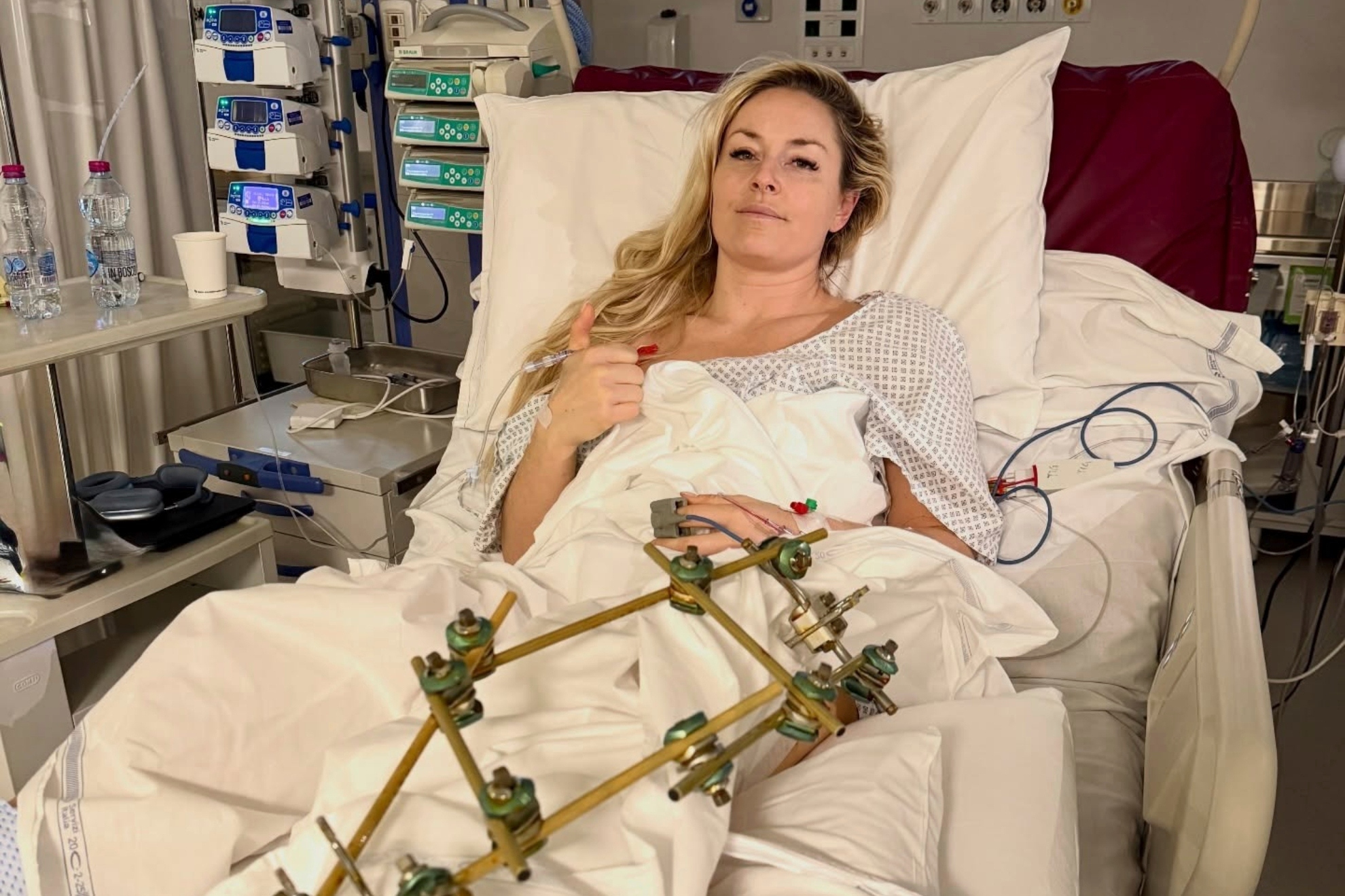 La primera foto de Vonn tras su primera intervención.