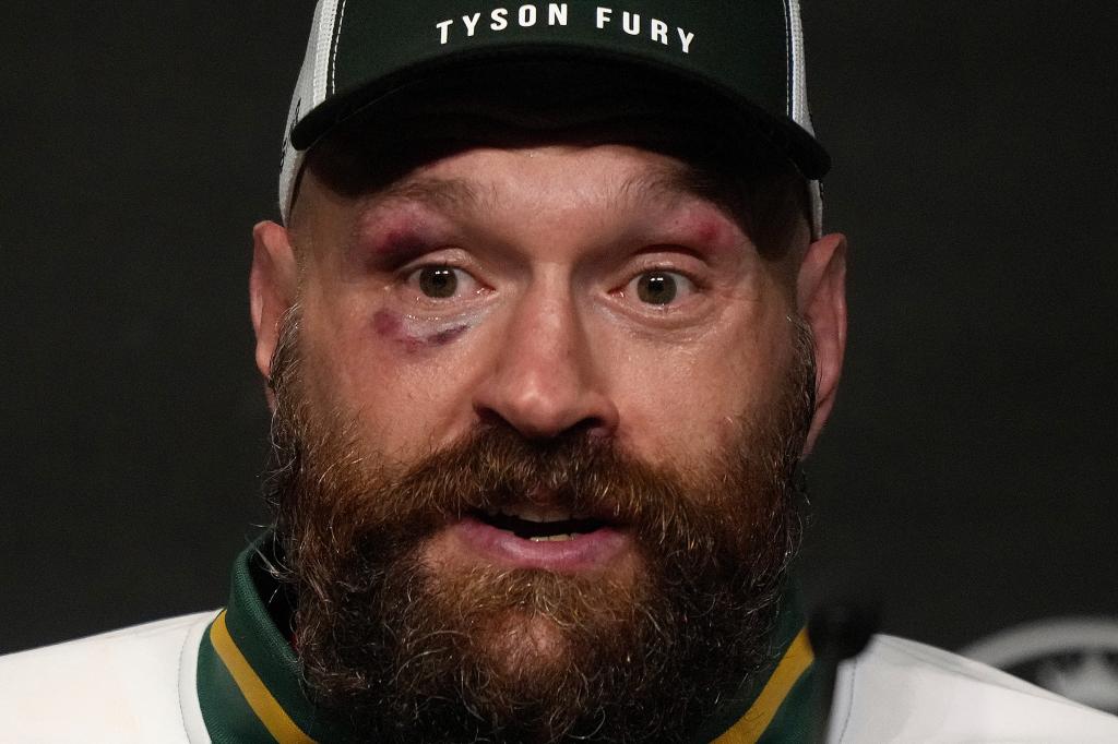 Tyson Fury, durante una rueda de prensa.