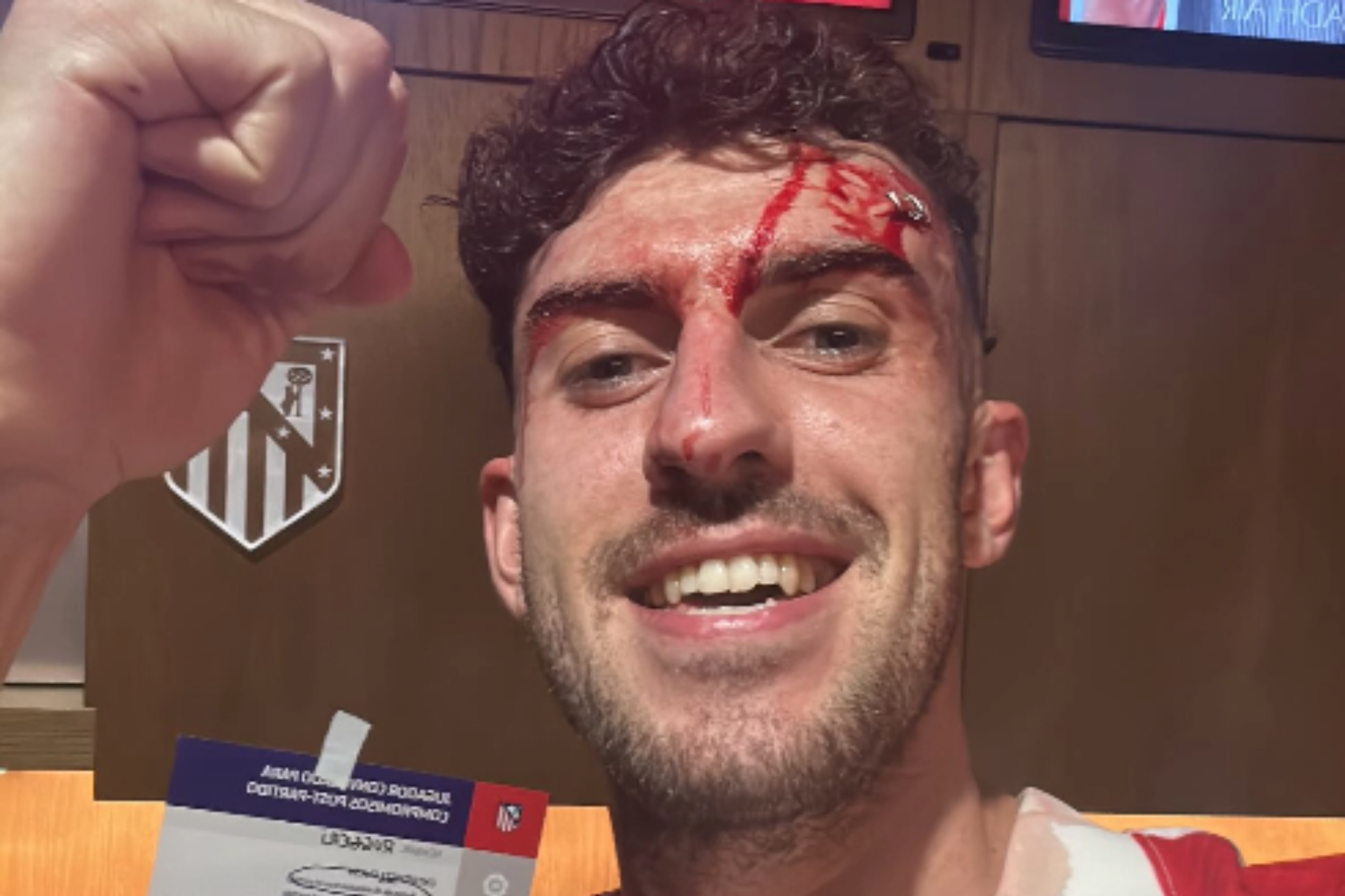 Matteo Ruggeri en el vestuario tras el codazo de Gavi