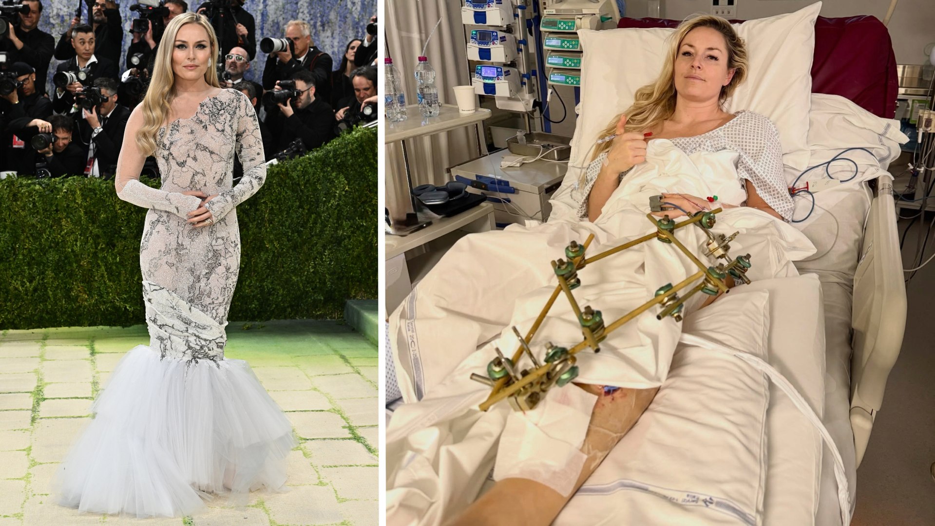 La popular esquiadora estadounidense fue una de las estrellas en la 'pasarela' del evento del año en Nueva York: "Estoy haciendo lo que puedo con las cartas que tengo, me ha tocado una mala mano... pero es mejor esto que estar en silla de ruedas".