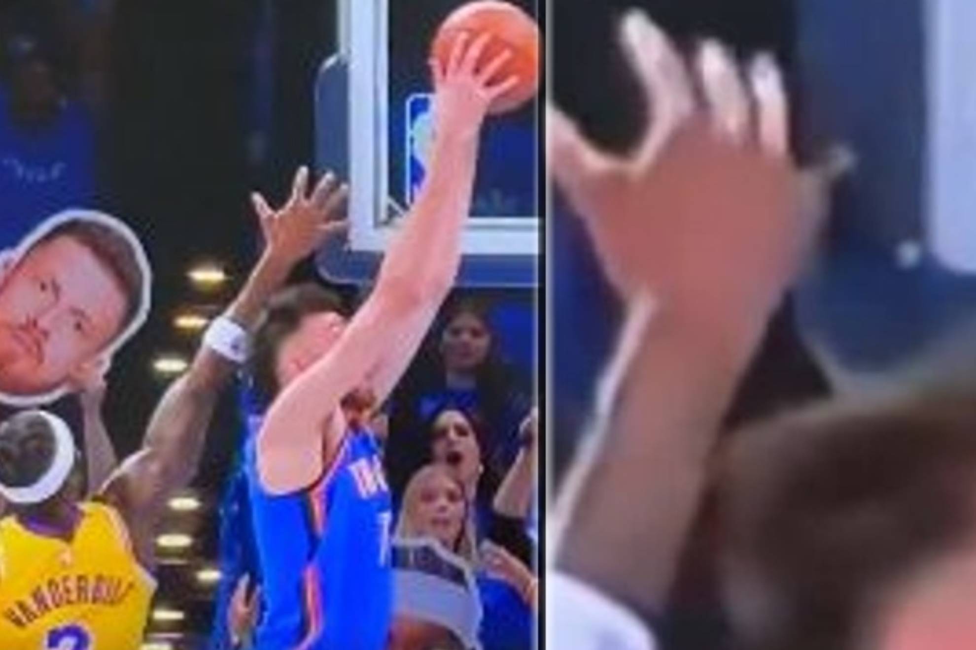Dolor extremo en los Lakers: Jared Vanderbilt se disloca el dedo contra tablero
