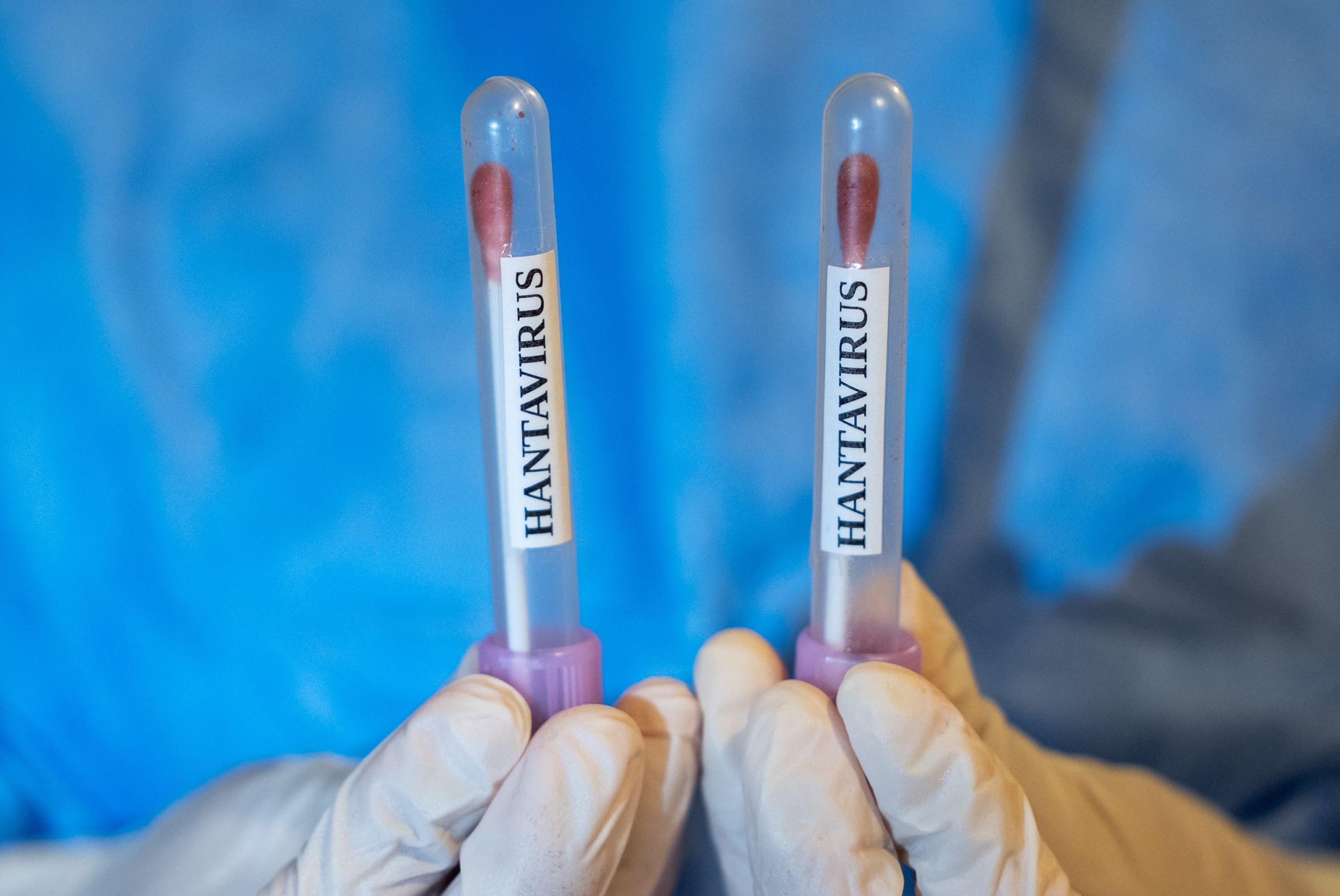 Hantavirus