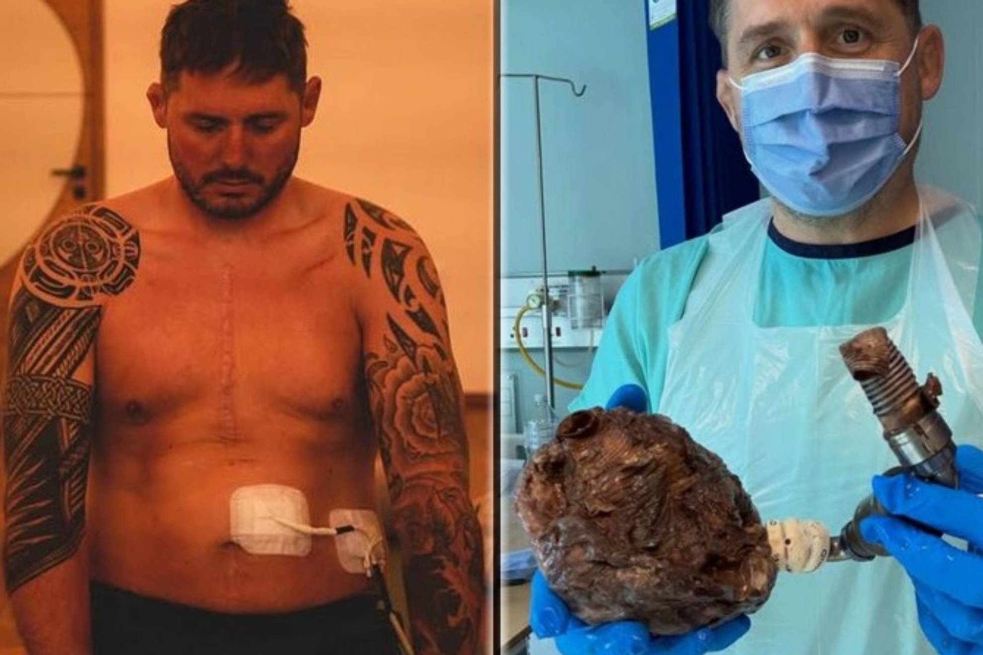 Rhys Thomas, jugador de rugby, sostiene su corazón entre sus manos: "Mi experiencia más surrealista"