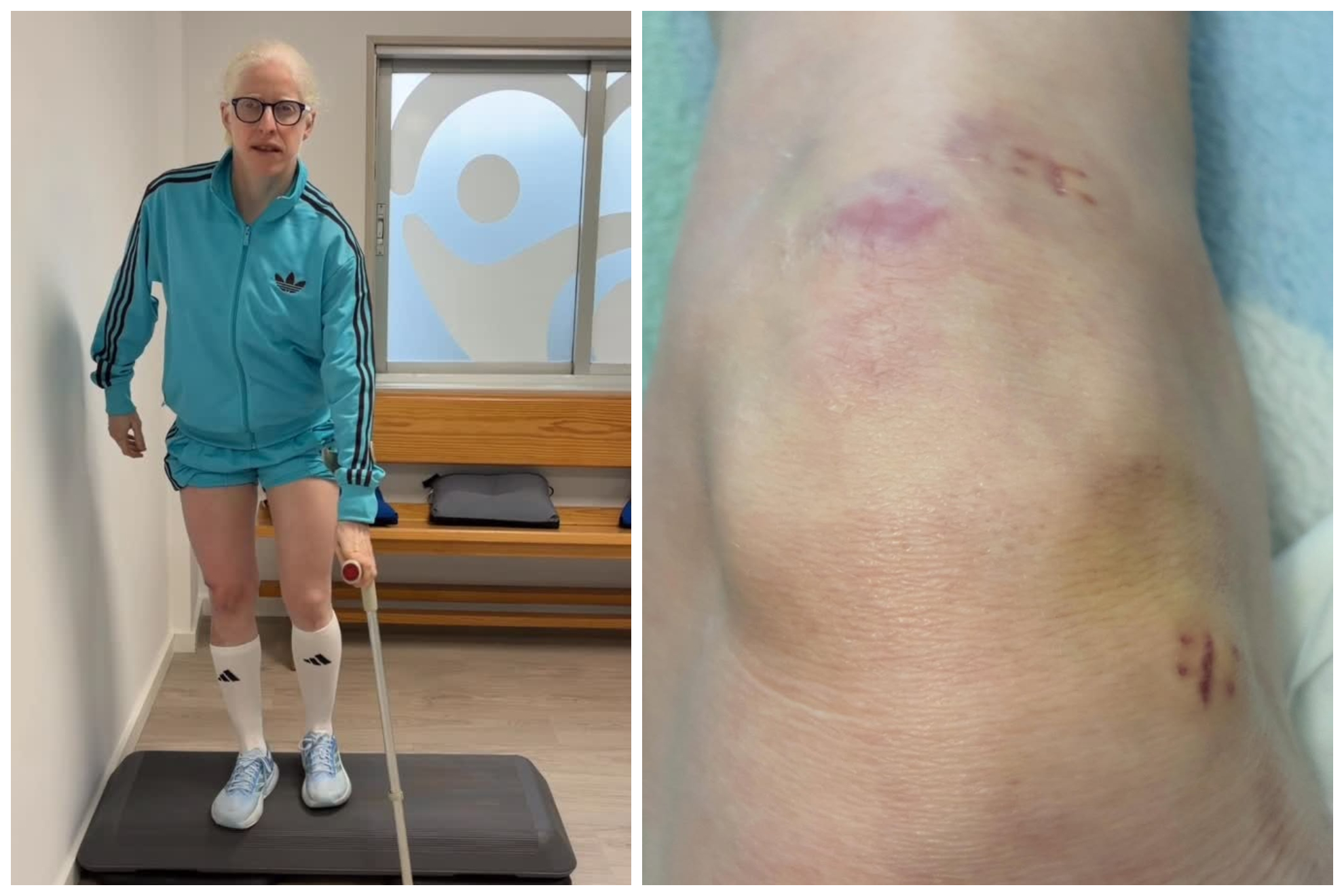 Susana Rodríguez, durante su recuperación de rodilla. @susirodriguezgacio