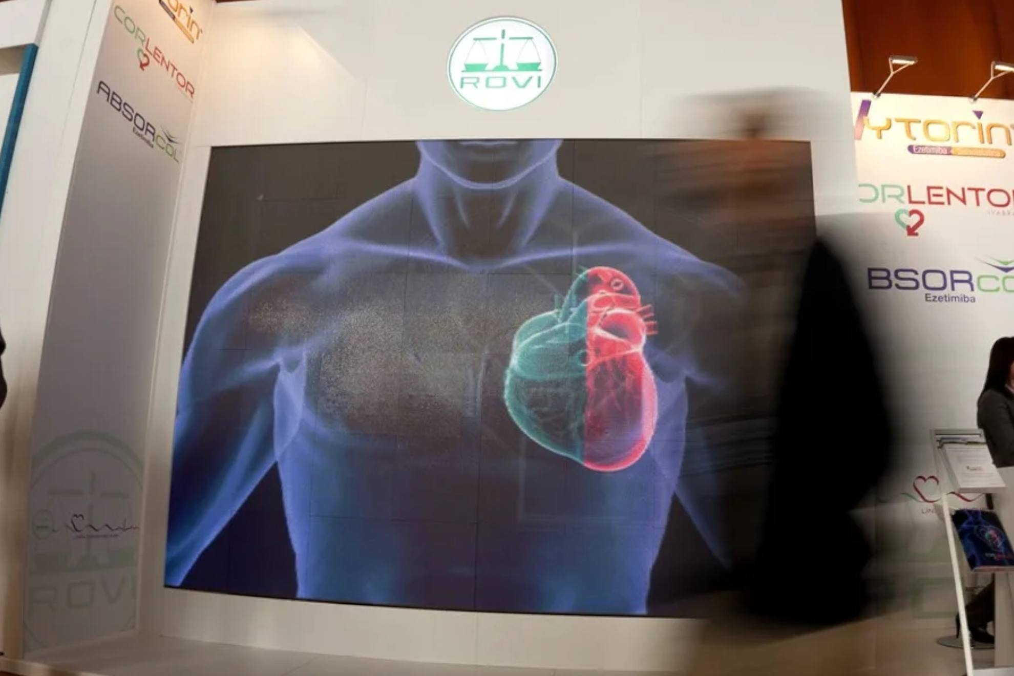 La investigación ha detectado placas de ateroma en las arterias de uno de cada 13 participantes de entre 18 y 29 años EFE