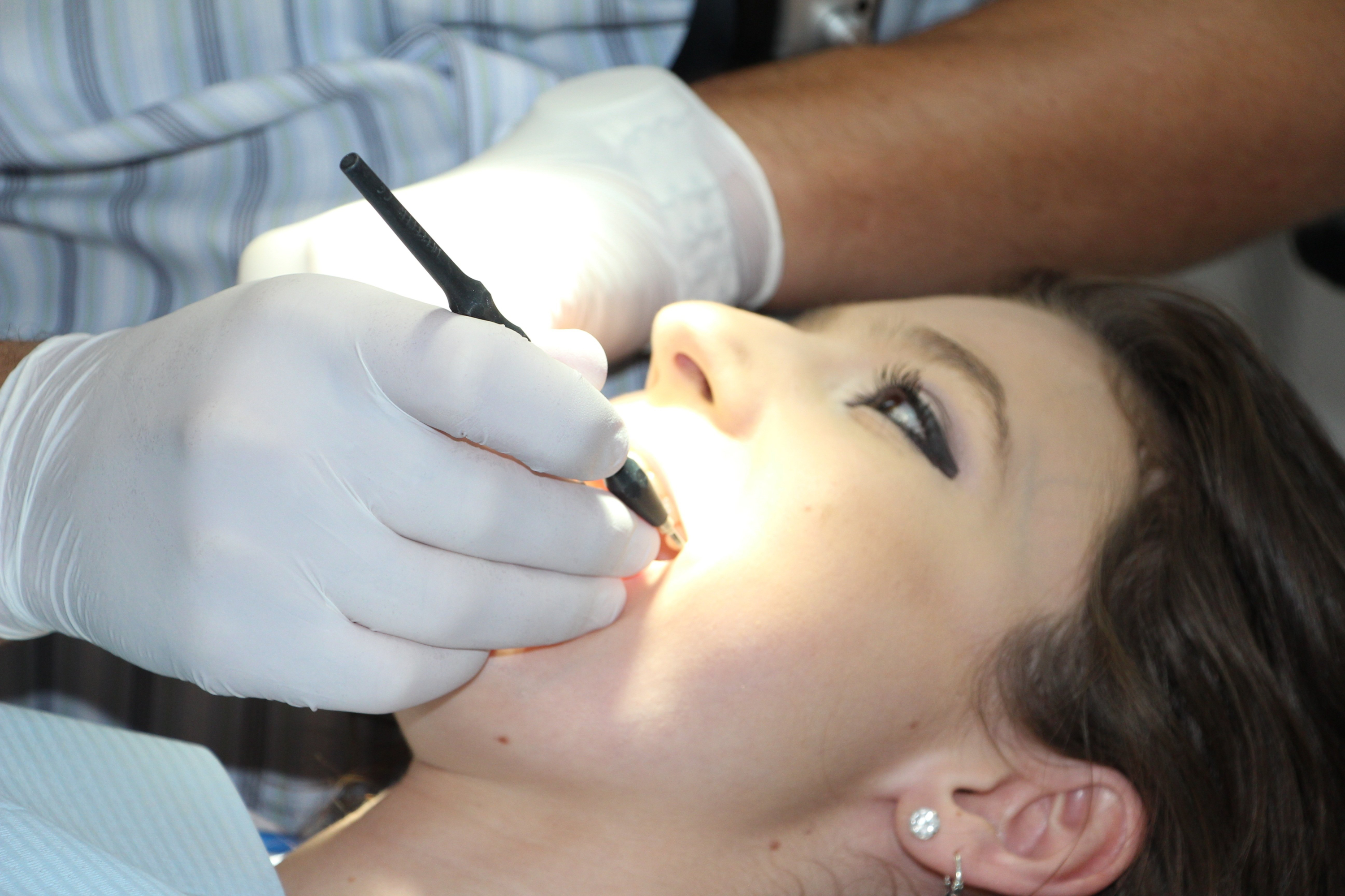 Debemos hacernos una limpieza dental anual