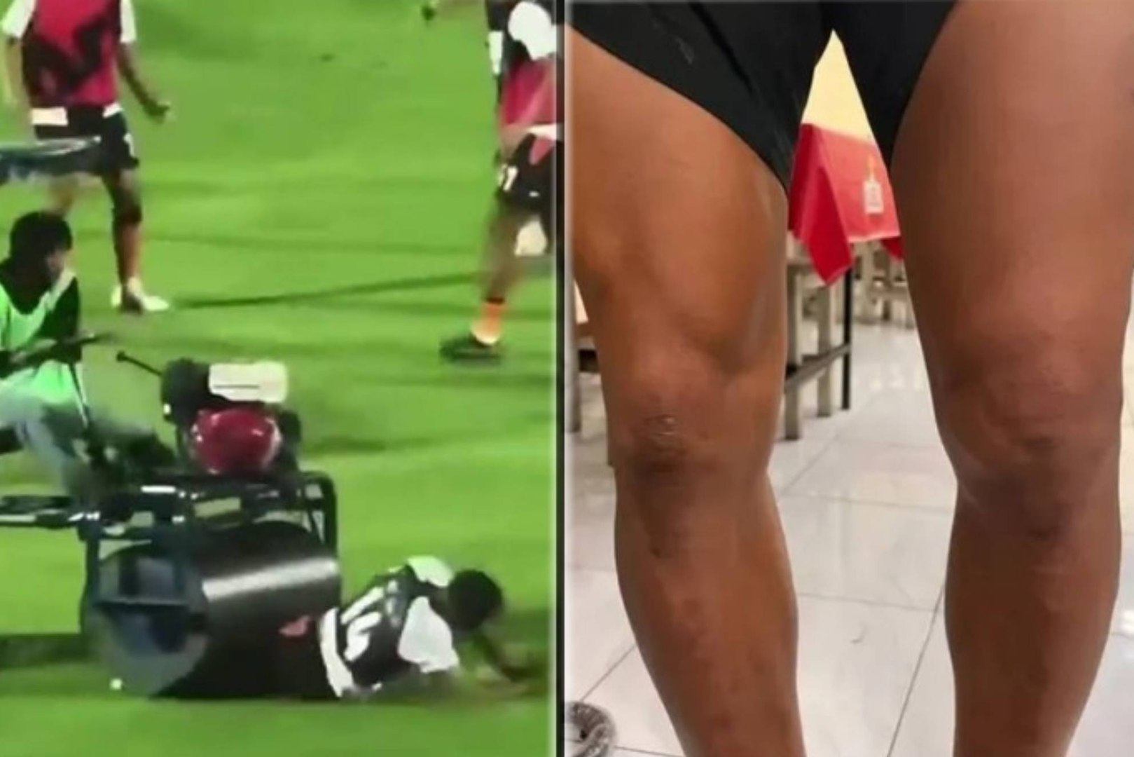  Andros Townsend, el futbolista internacional con Inglaterra que fue aplastado por una aplanadora en el descanso de un partido, ha desvelado que prescindió de la medicación tras su atropello y que prefirió apostar por una particular dieta como remedio a sus problemas físicos. 