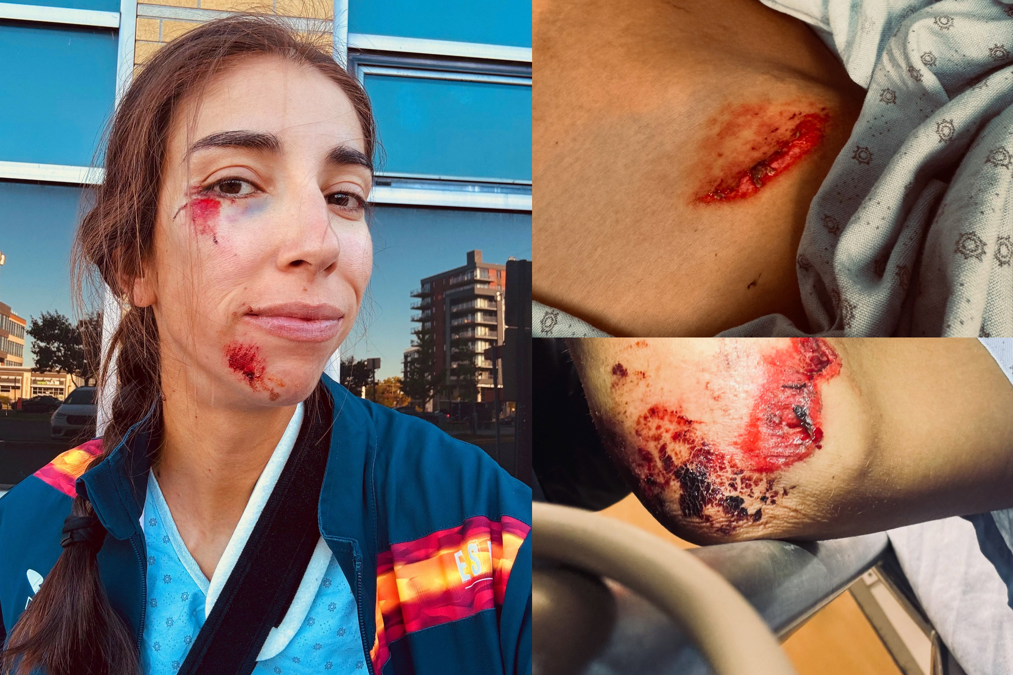 El duro accidente de Sandra.