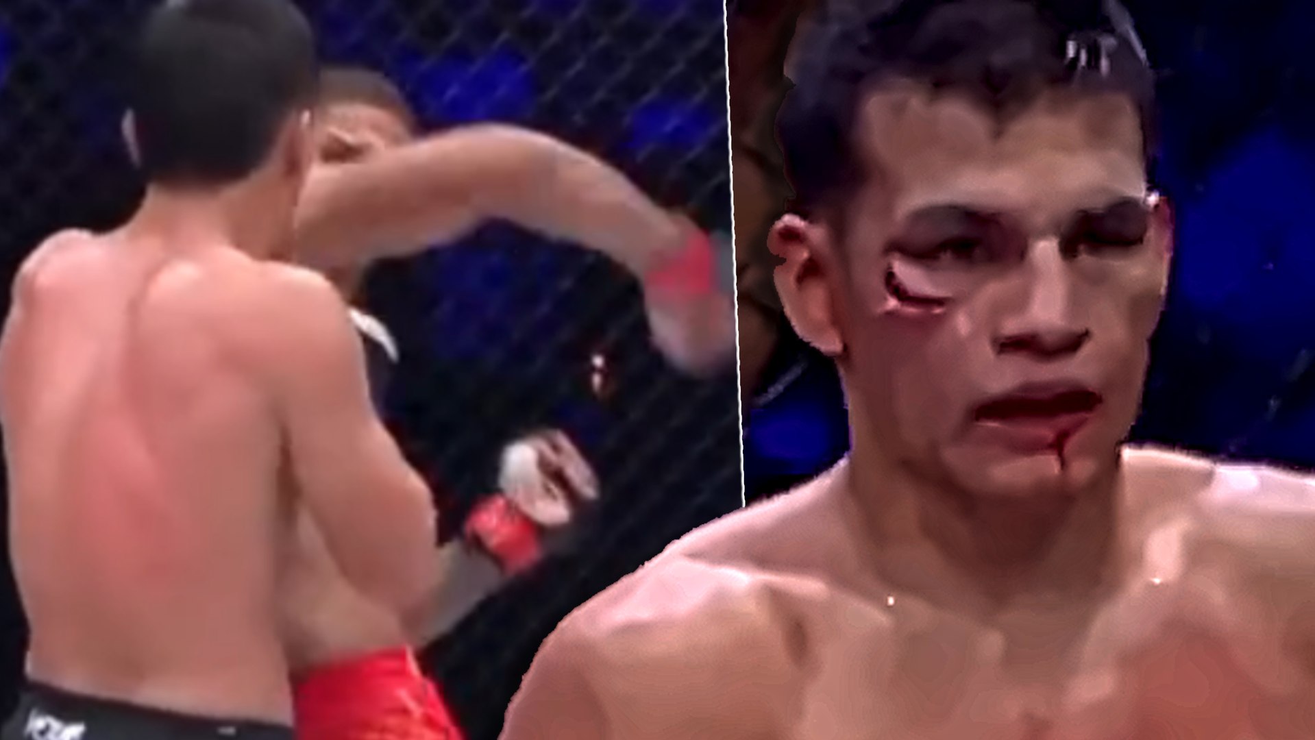 El combate entre Batista y Hernández en el WOW 32 de Sevilla dejó este golpe en los primeros compases. El codo giratorio impactó en la cara del rival, dejándole un corte en el pómulo.  