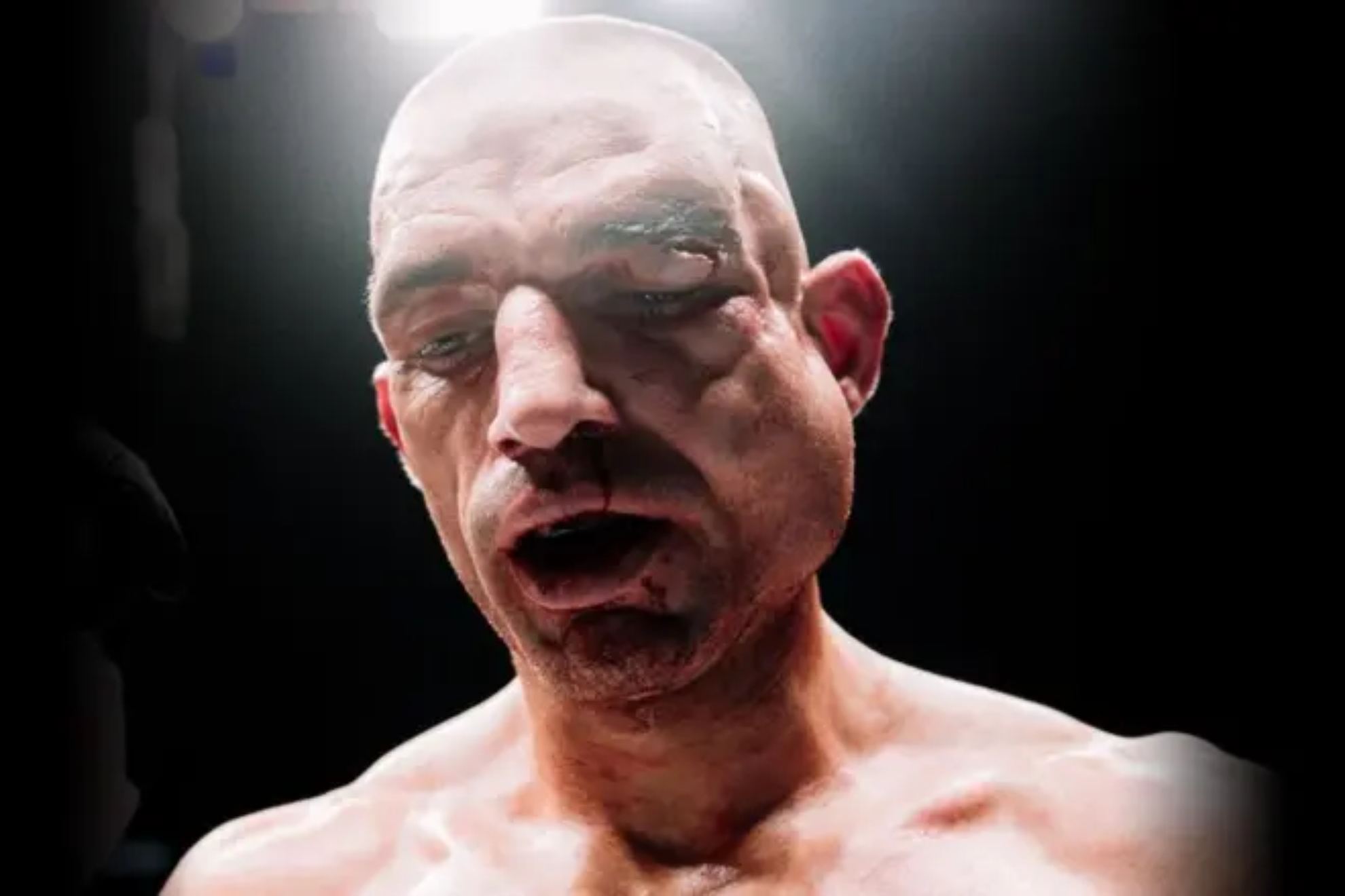 Boxeo