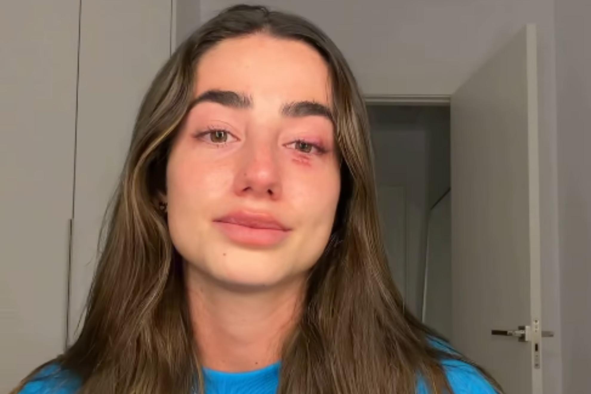 Captura de pantalla del vídeo en el que Lola Lolita ha anunciado que deja temporalmente las redes sociales. INSTAGRAM: @LOLALOLITA