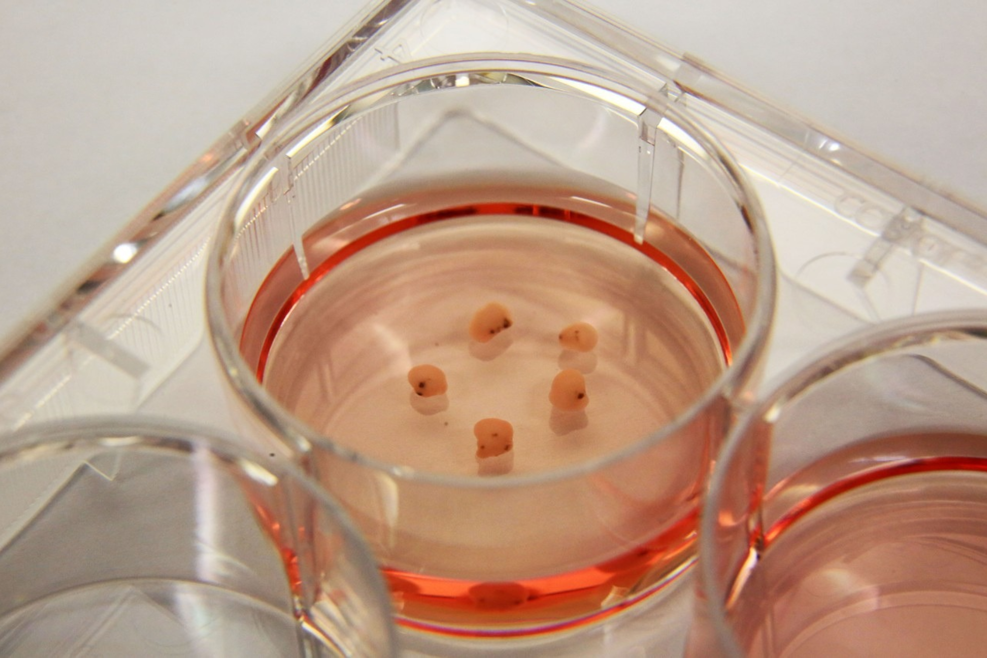 Estos microcerebros se cultivan a partir de células madre y se obtienen reprogramando células adultas de la piel o la sangre