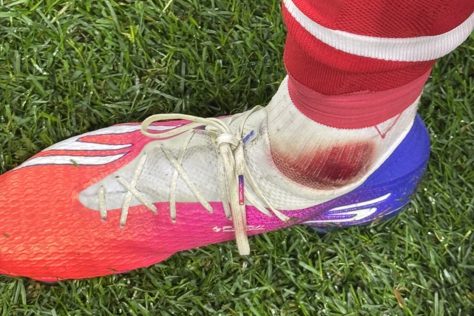 Pau Víctor estalla con el pie ensangrentado y el Braga denuncia tras la derrota: "Basta ya"de la imagen