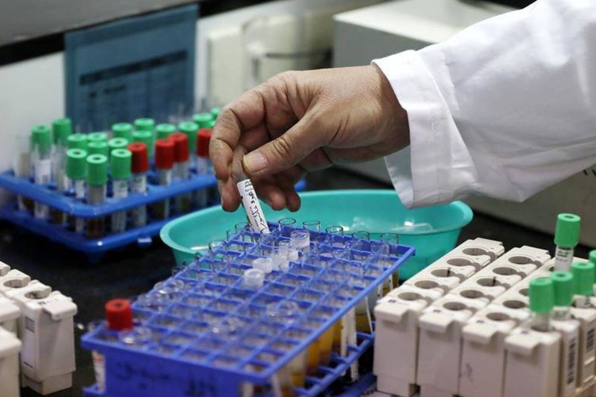 Científicos descubren que niveles bajos de testosterona pueden hacer que el azúcar sea más dañino para el hígado EFE